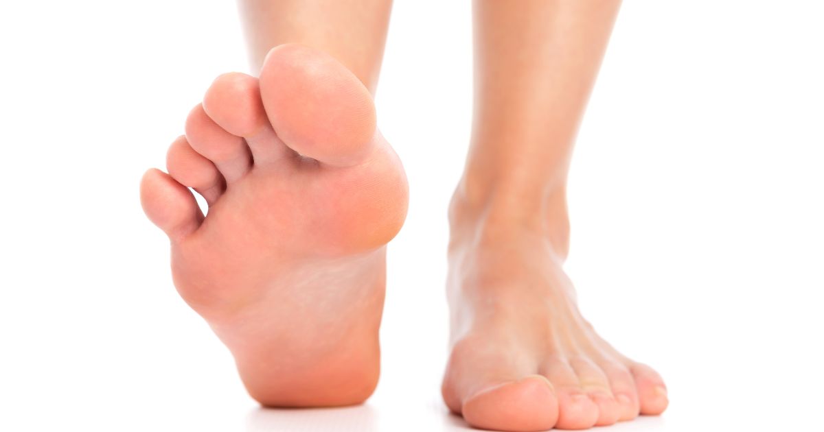 Løping og plantarvorter: Er det vondt?